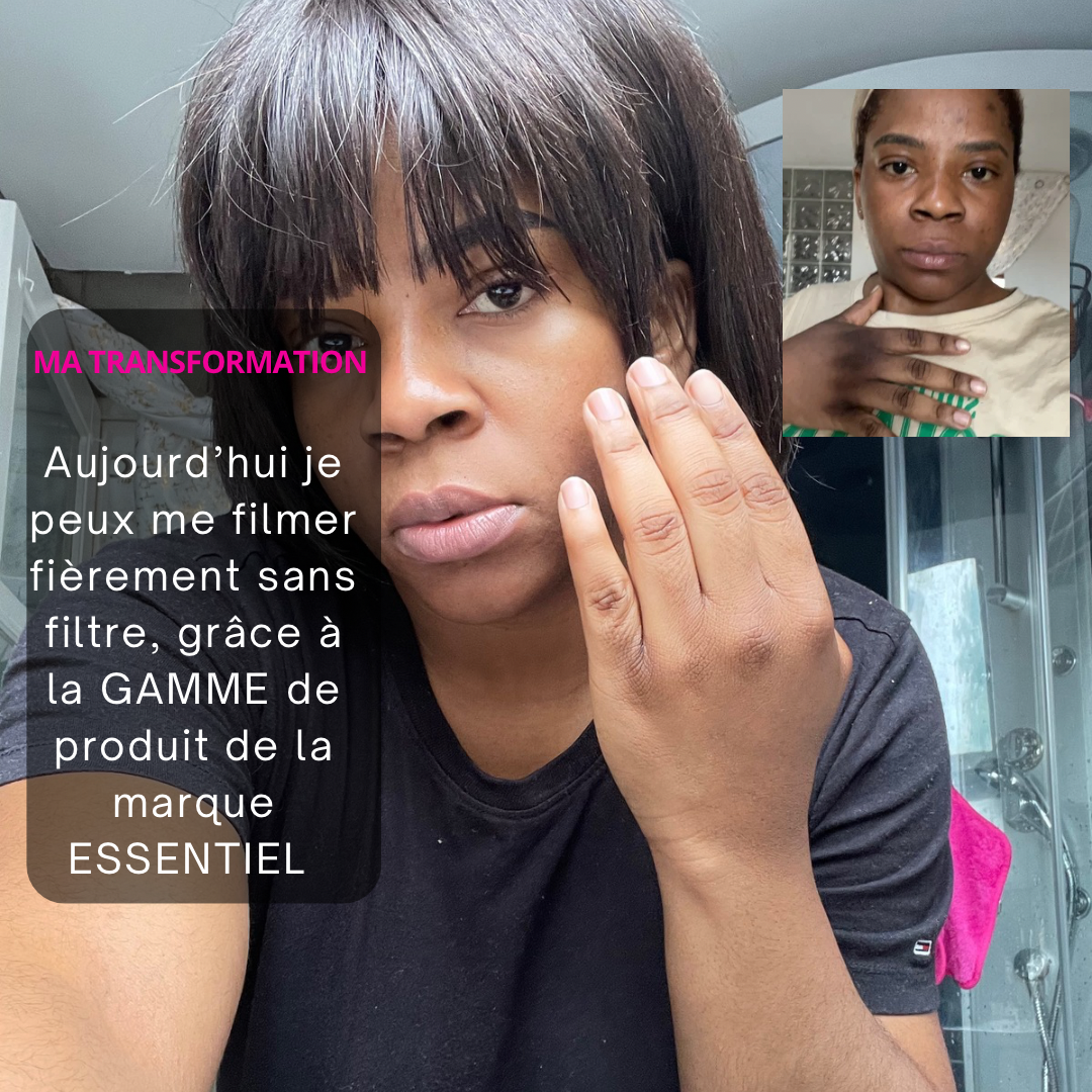 Sérum Anti-Quintos Tenaces : Le Secret des Peaux Unifiées et Sublimées