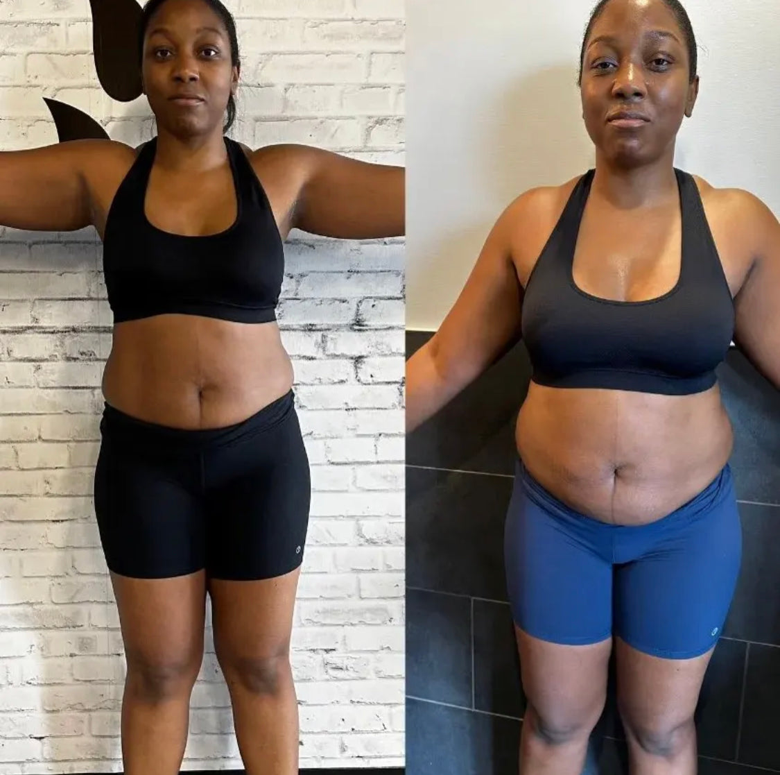 Les 10 Ingrédients Naturels Essentiels pour Stimuler la Perte de Poids