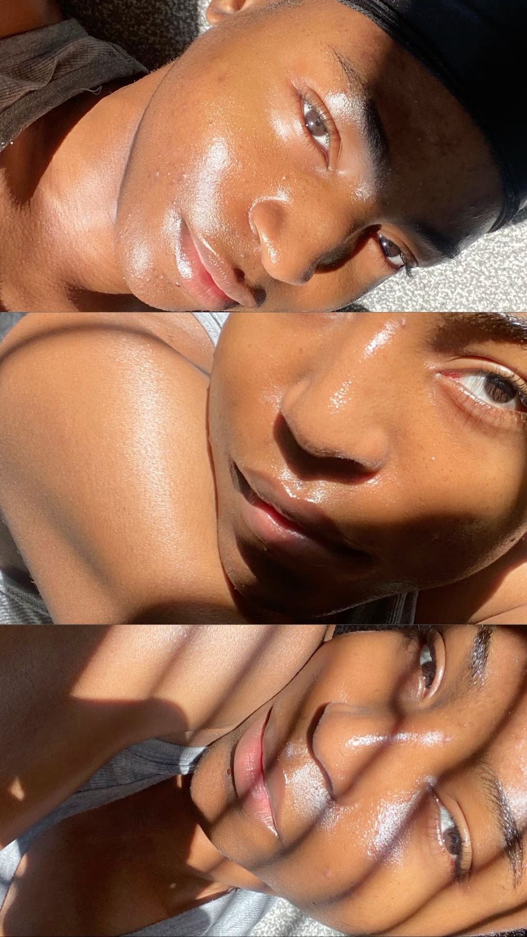 Vaincre l'Hyperpigmentation : Votre Guide Ultime pour une Peau Radieuse