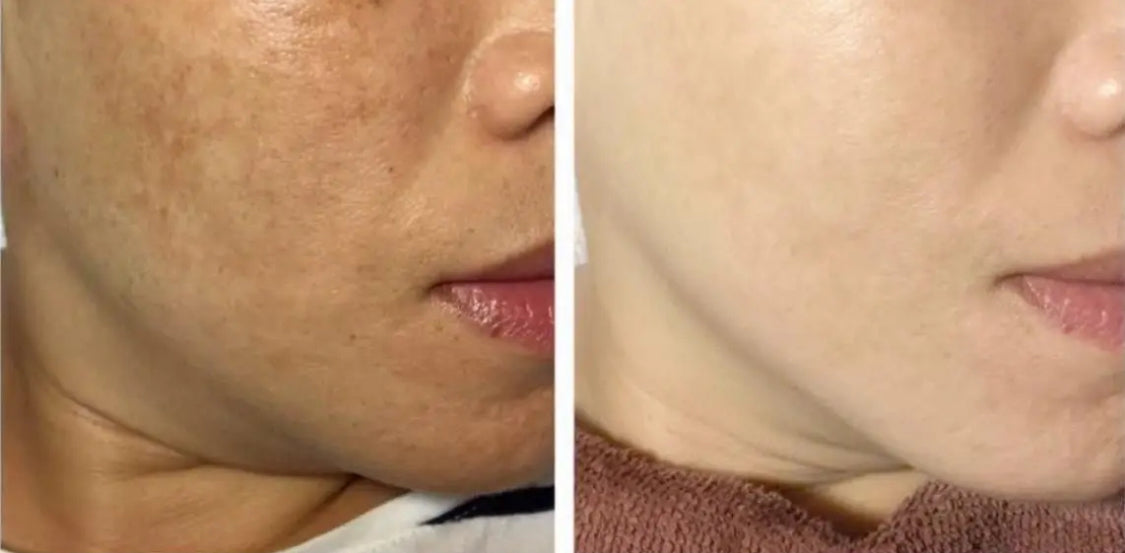QUELS SONT LES EFFETS SECONDAIRES DU GLUTATHION QUELS SONT LES EFFETS SECONDAIRES DU GLUTATHION