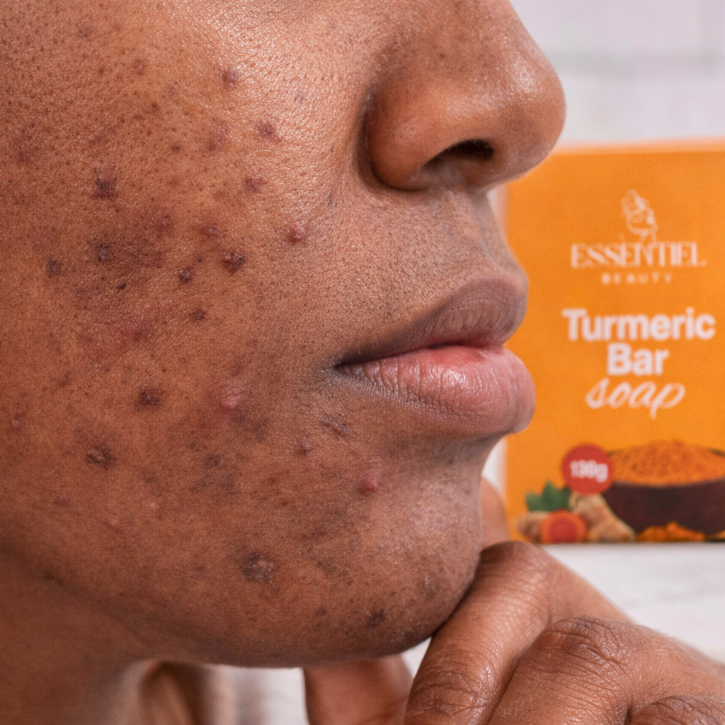 SAVON À L'ACIDE KOJIC (CURCUMA) ANTI IMPERFECTIONS