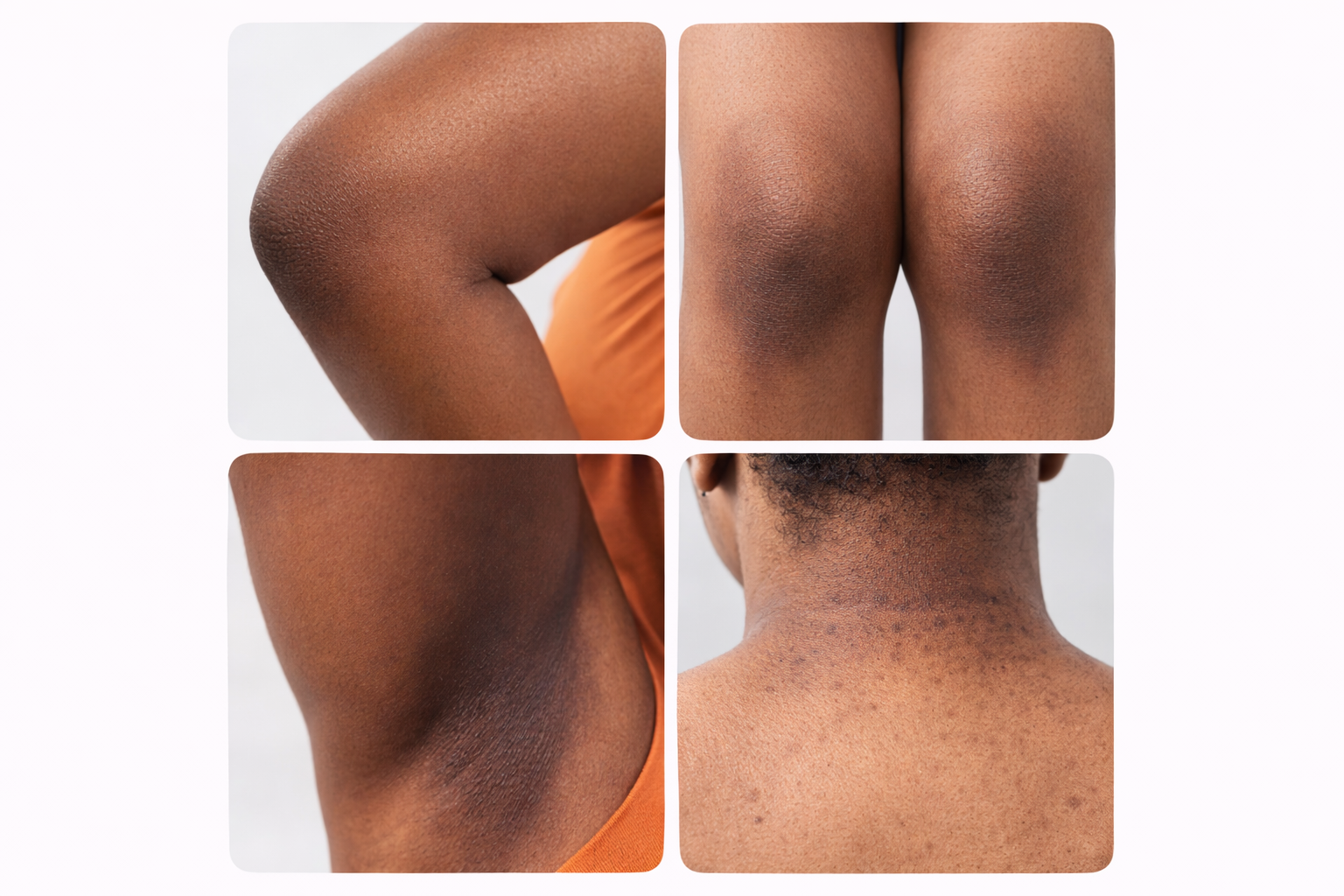 GOMMAGE SUPER ÉCLAIRCISSANT AU CURCUMA CONTRE L'HYPER PIGMANTATION ET ANTI-QUINTO