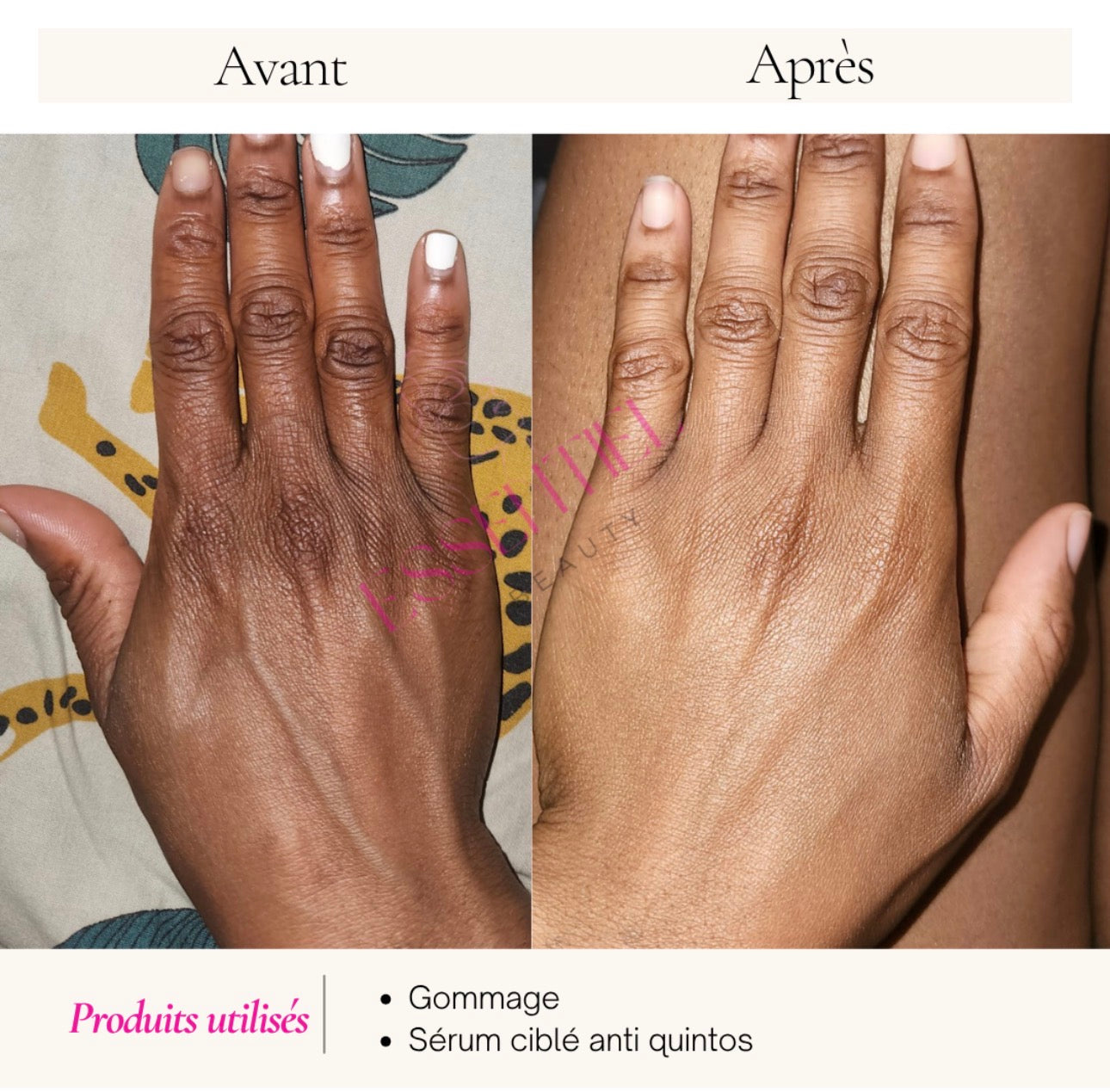 SÉRUM CORRECTEUR CIBLÉ ANTI-QUINTOS