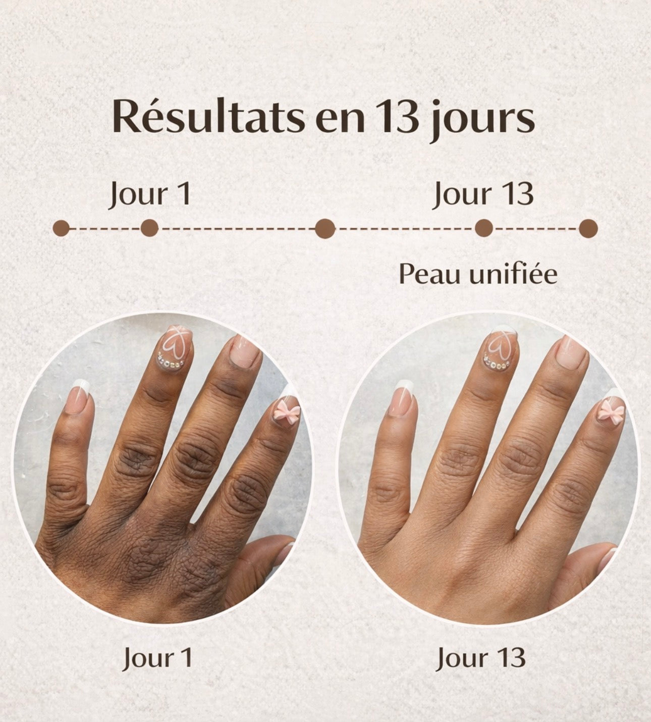 SÉRUM CORRECTEUR CIBLÉ ANTI-QUINTOS