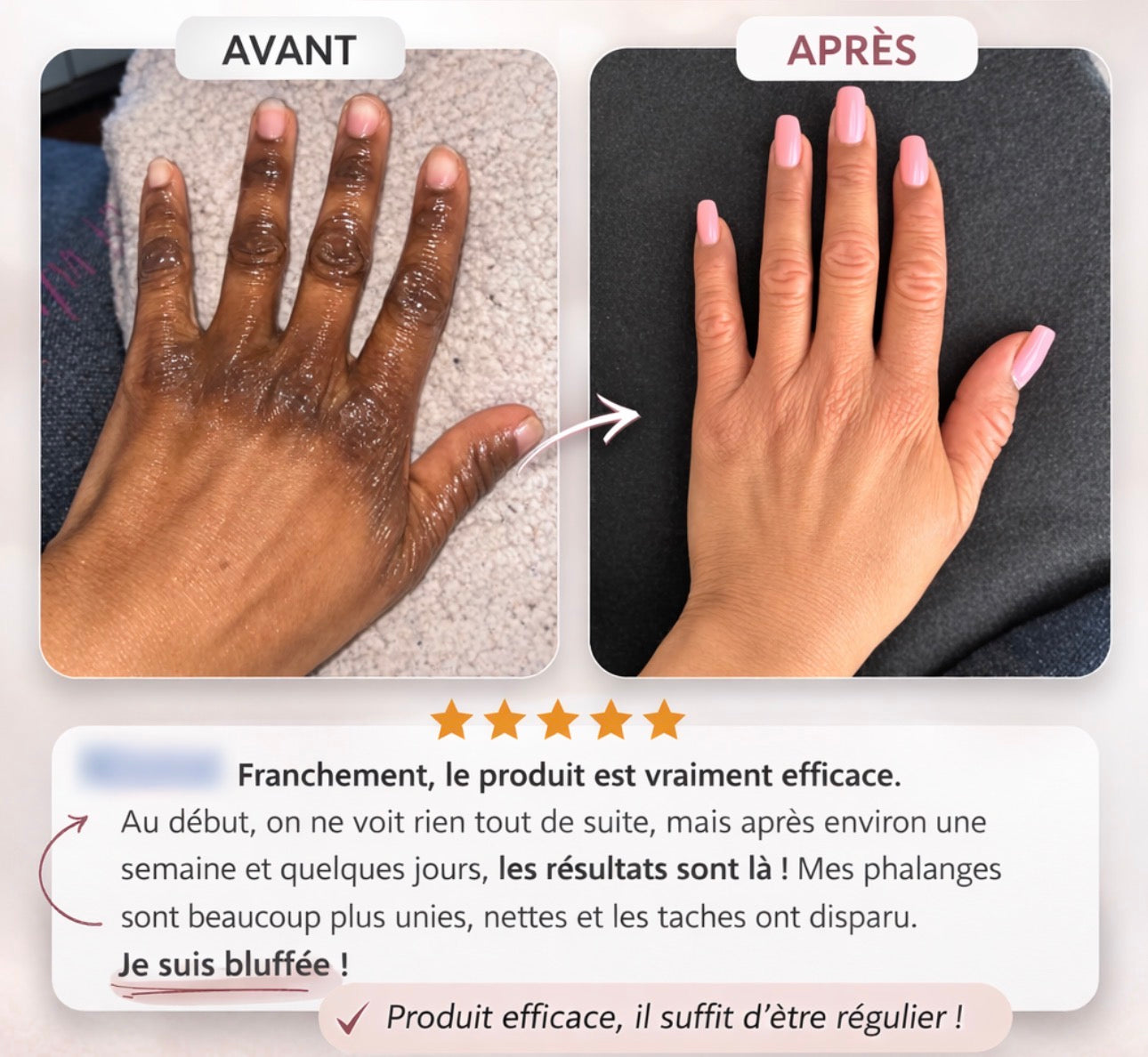 SÉRUM CORRECTEUR CIBLÉ ANTI-QUINTOS